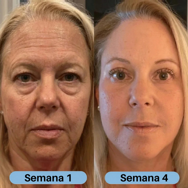 VoluFine | Sérum de colágeno coreano para pieles maduras. 1+1 GRATIS