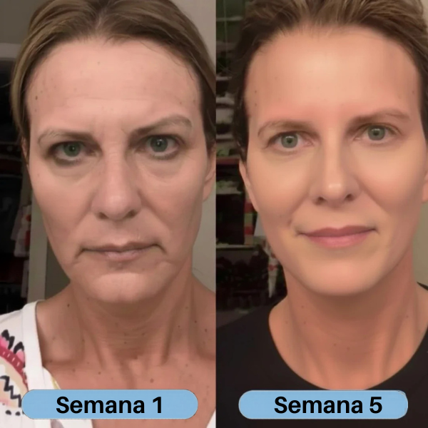 VoluFine | Sérum de colágeno coreano para pieles maduras. 1+1 GRATIS